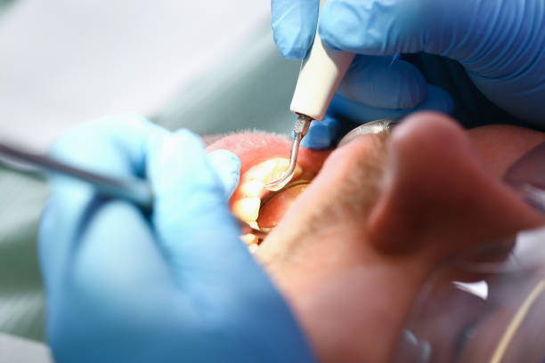 Best Tooth Infection Emergency Dentist  in Milton, NY