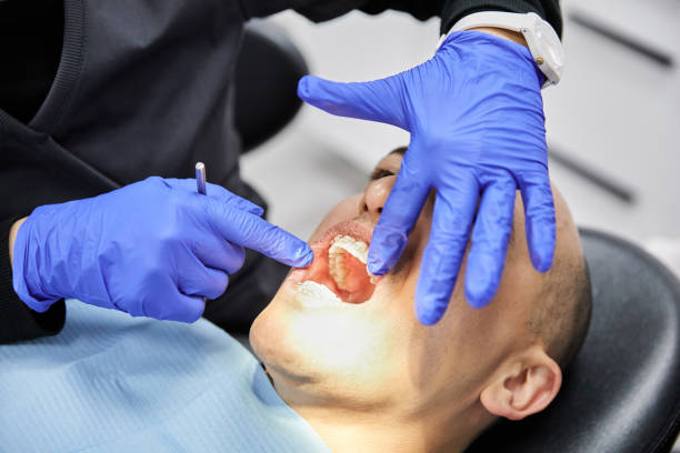 Best Urgent Tooth Repair  in Milton, NY